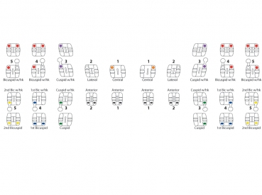 miniPrevail™ TWIN (miniPerform™), Set 5-5, Roth .022"