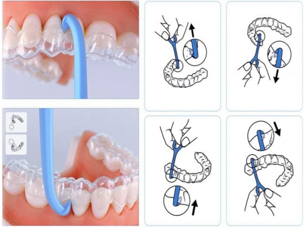 Retainer Retriever