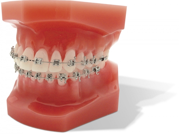 miniPrevail™ TWIN (miniPerform™), Set 5-5, Roth .022"